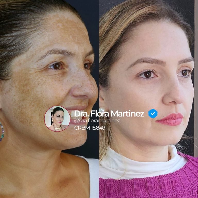 Imagem oficial da galeria da Flowers Clinic, caso individual 3.